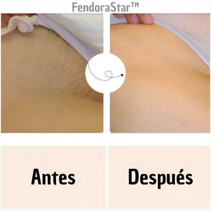 Depiladora de laser IPL PRO FendoraStar™